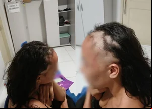 Mulher é investigada por raspar a cabeça e simular agressão para denunciar companheiro